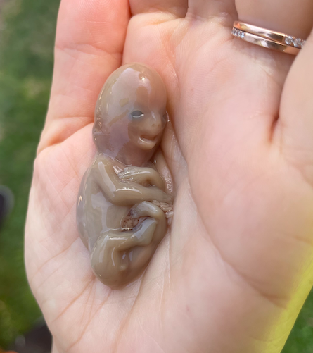 Passing tissue (gross picture warning) - August 2018 Babies